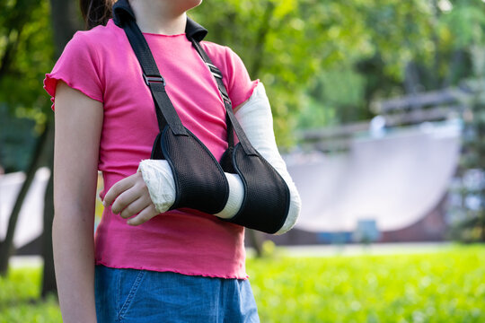 Girl with bone fracture in full arm cast and sling standing near skatepark summer. Childhood injury and safety concept