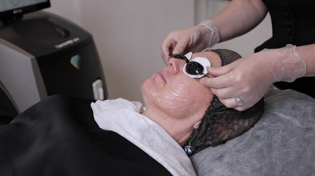 Female aesthetician in gloves carefully places protective eye pads on a client undergoing a facial laser treatment, with modern spa equipment visible in the background. Slow motion footage