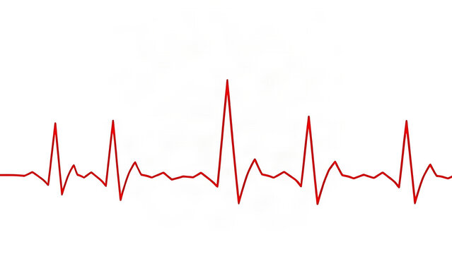 Red ECG line pattern transitioning from flat to sharp peaks on white background, medical graphic.