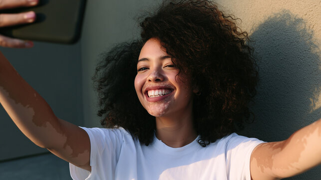 Smiling woman with curly hair taking a selfie, visible vitiligo patches around her mouth and on both arms, facial depigmentation, acrofacial vitiligo, leukoderma, achromic macules,