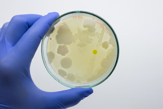 Growing bacterial colonies on a petri dish with agar medium, scientist's hand in a blue glove holding a petri dish on a white background.