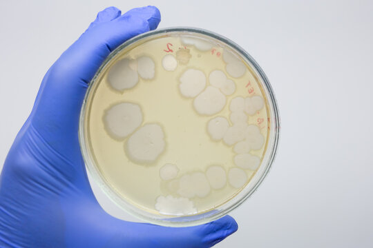 Typical bacillary colonies of Bacillus subtilis bacteria on a nutrient medium in a petri dish held by a scientist in his hand on a white background.