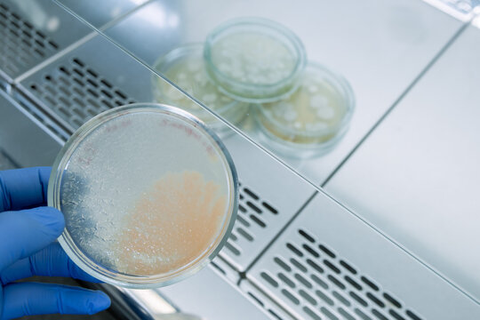 Analysis of a colony of pink-colored bacteria in a petra dish in laboratory conditions under aseptic conditions, in the background are other Petri dishes.