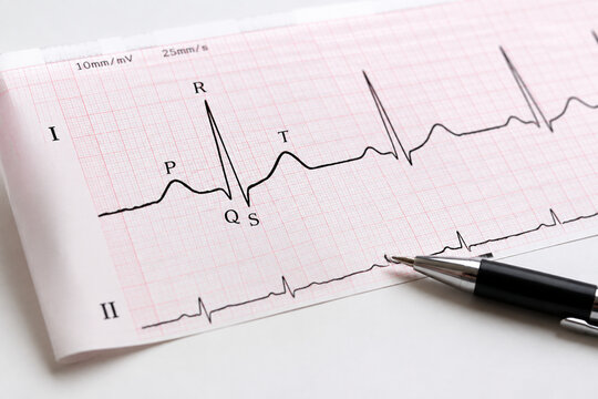 ECG printout with PQRST wave pattern on white table, medical heart health