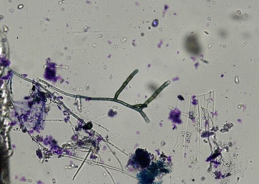 soil microorganisms under a microscope including amoeba, flagellates, nematodes, fungi, bacteria	