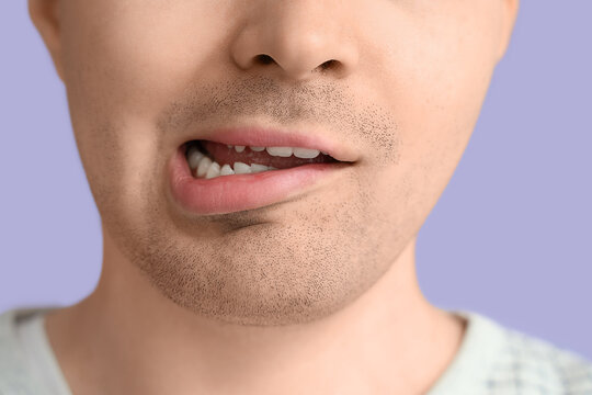 Young man on lilac background, closeup. National Cerebral Palsy Awareness Month