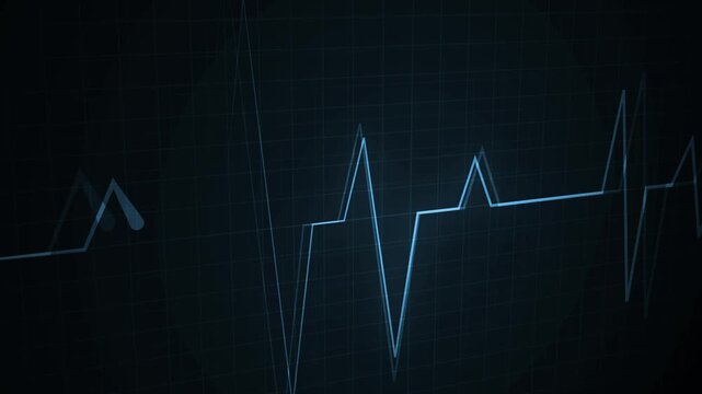 Ekg style line graph on a grid background with glowing peaks and dips animation, Heartbeat pulse signal and data chart concepts