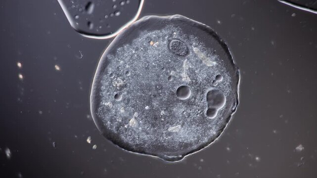 LivingAmoeba close up showing cellular activity and cell organelles at work 
