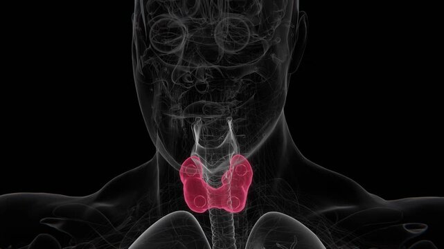 An enlarged parathyroid gland is an abnormal increase in the size of one or more parathyroid glands, often associated with excessive production of parathyroid hormone and disrupted calcium regulation