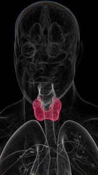 An enlarged parathyroid gland is an abnormal increase in the size of one or more parathyroid glands, often associated with excessive production of parathyroid hormone and disrupted calcium regulation
