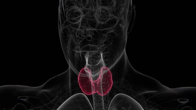 Hashimoto's thyroiditis is an autoimmune disorder in which the immune system attacks the thyroid gland, often causing chronic inflammation and reduced thyroid hormone production in UHD