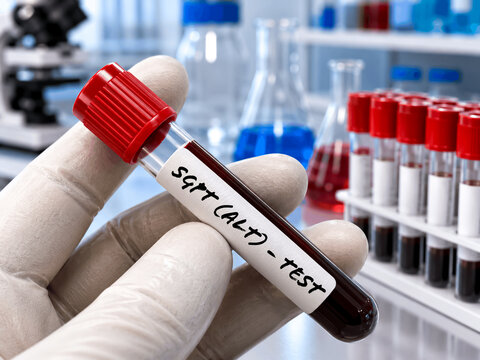 Blood sample for Liver function, SGPT and SGOT test. A medical testing concept with tube vector in the laboratory background. illustration