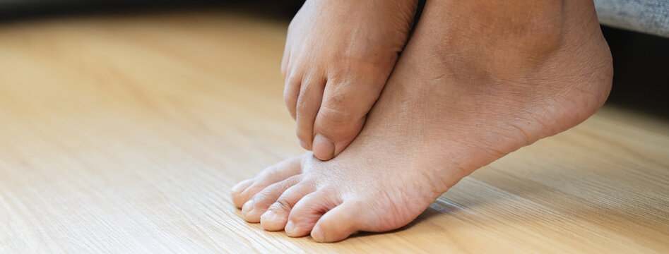 Close-up bare feet of person feeling itchy and irritated try to scratching by toe.