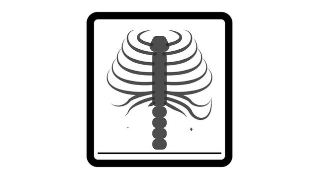 human rib or thoracic cage view from the front animation, chest wall anatomy diagram animated video, thorax skeletal and sternum motion graphics
