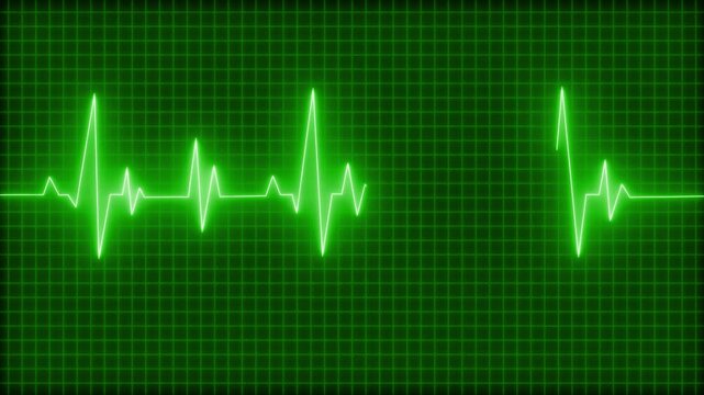 Glowing ecg heartbeat waveform on grid background animation, Electrocardiogram waveform glowing heartbeat pulse lines across screen