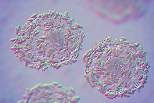 Clue cells, 3D illustration of squamous epithelial cells coated with Gardnerella bacteria, associated with bacterial vaginosis