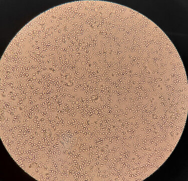 High density of yeast cells under laboratory microscope