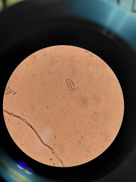 Parasite egg Enterovius vermicularis under microscope in clinical sample