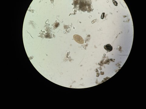 Parasite egg in microscopic stool analysis in clinical laboratory