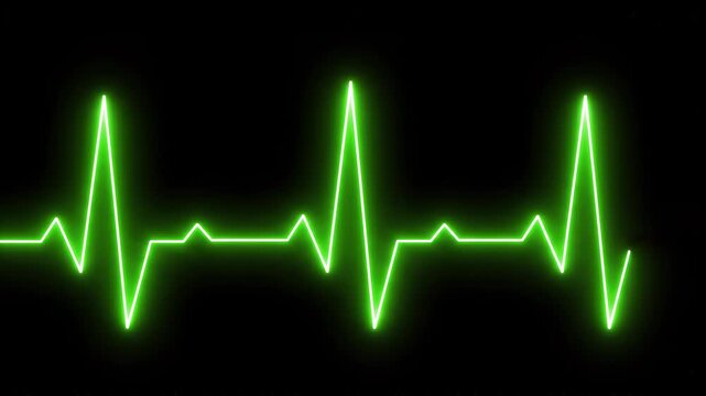 Green EKG Heartbeat Line Animation Displayed on Black Background with Subtle Motion