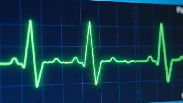 Heartbeat waveform pulsing on a medical monitor screen with soft blue background lighting