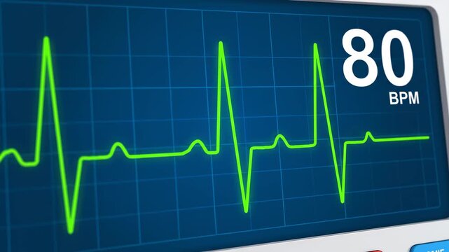 Vital signs monitor displaying a steady heart rate rhythm during a medical procedure in a dimly lit operating room