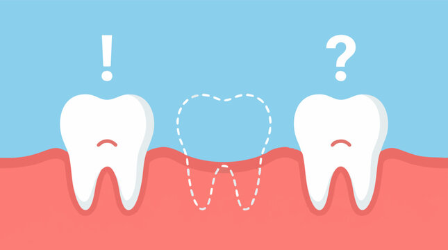 Missing tooth and dental implant concept illustration for oral health