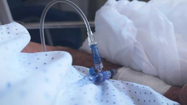 Close-up of a hospital patient's arm with an IV catheter inserted.