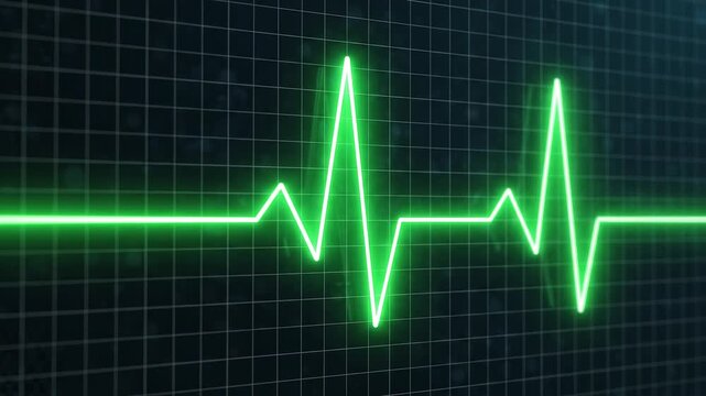 Green electrocardiogram pulse line evolving on a digital monitor grid with cinematic motion