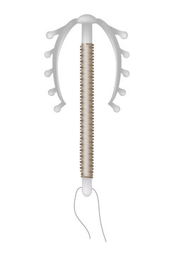 Intrauterine Device IUD Contraceptive Copper Coil Medical Vector Illustration. Copper IUD Birth Control Intrauterine Contraceptive Device Medical Illustration