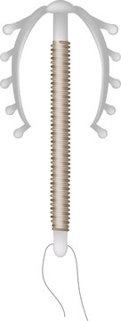 Intrauterine Device IUD Contraceptive Copper Coil Medical Vector Illustration. Copper IUD Birth Control Intrauterine Contraceptive Device Medical Illustration