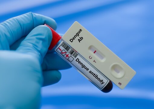 Blood sample tube of patient negative result for dengue antibody.