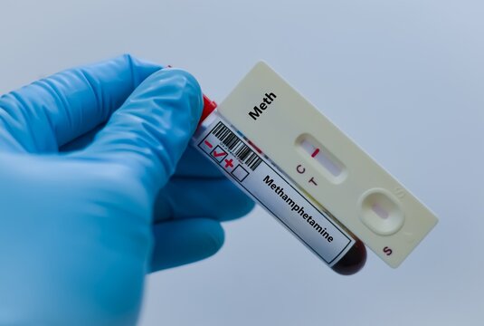 The sample tube of patient negative result for methamphetamine.