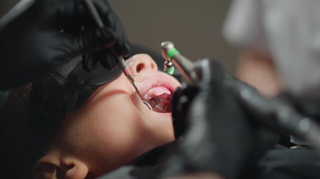 Close up of young boy receiving dental treatment with black protective eyewear. Dental professional wearing gloves uses specialized tools to examine and work inside open mouth focusing