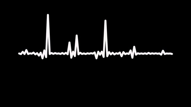 White line voice record waveform visual, dynamic audio frequency spectrum overlay, green screen music equalizer rhythm bar, abstract podcast sound wave loop, digital transparent wave