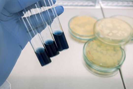 Three test tubes with samples of petroleum products are being used in a laboratory to study bacteria that decompose oil.