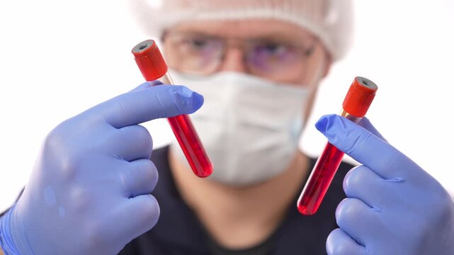 The doctor examines test tubes with blood tests. Blood test in a test tube in a doctor's hands.