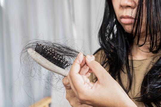 Asian woman holding a hairbrush with lost hair, suffering from hair loss, alopecia, or thinning hair problem. Close-up portrait of female patient touching fallen hair strand in scalp healthcare concep
