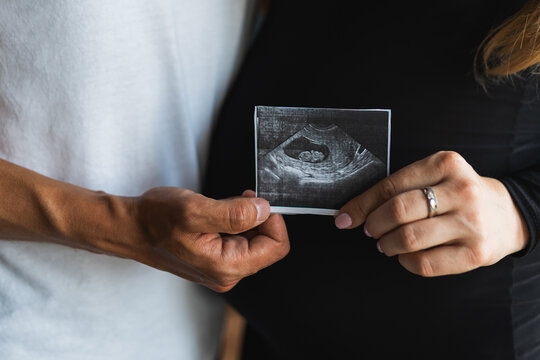 Couple holding ultrasound scan image of future baby expecting child. Conscious parenting and mindful pregnancy journey of young loving couple.