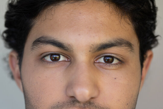 African American man holding steady gaze toward camera in neutral room showing mole