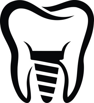Isolated black vector icon of a dental implant for clinical dentistry