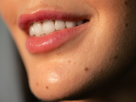 Perfect smile macro