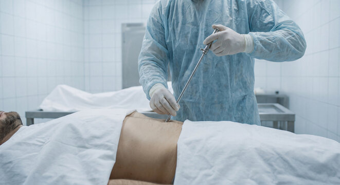 A forensic pathologist in sterile protective gown and gloves works meticulously over the exposed abdomen of a cadaver draped in white sheets on an autopsy table.