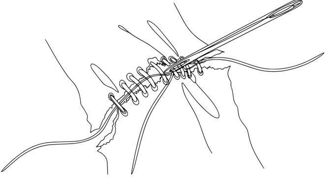 Surgical Suture Needle and Thread Closing Wound Isolated