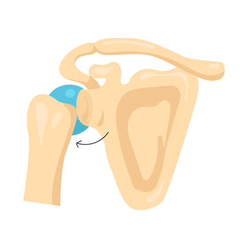 Shoulder Dislocation Types Medical Illustration
