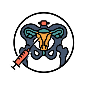 Hysterosalpingogram HSG Fertility X-Ray Icon for Gynecology
