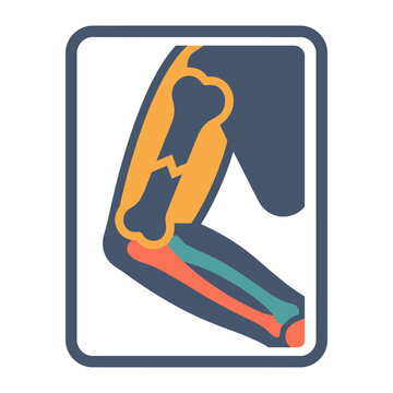 Monkey Primate Arm Fracture X-Ray Icon for Zoo Veterinary