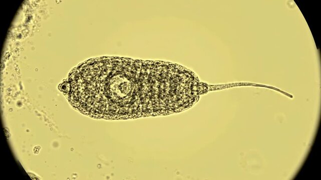 Leishmania parasite with a stable elongated oval body and thin flagellum slowly moving through a clean biological fluid environment