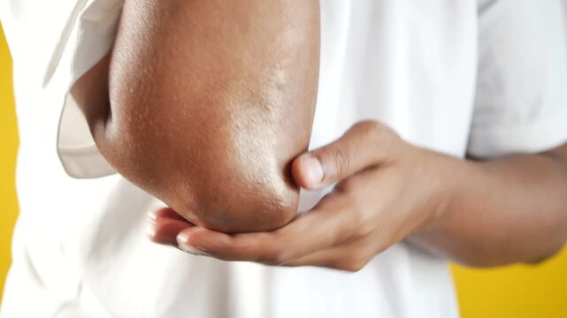 Close up of man with dry itchy skin rubbing his elbow to relieve irritation and scratching scaly patches