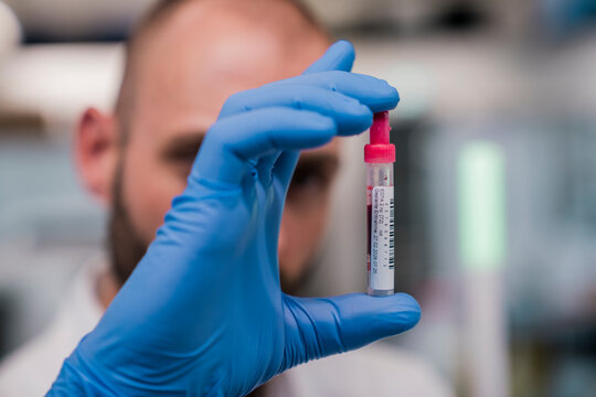 A male scientist holds a blood sample tube in a laboratory